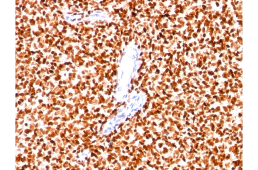 Immunohistochemistry - Anti-NKX2.2 Antibody [SPM564] (A249506) - Antibodies.com