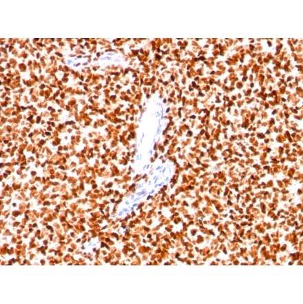 Immunohistochemistry - Anti-NKX2.2 Antibody [SPM564] (A249506) - Antibodies.com