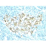 Immunohistochemistry - Anti-NKX2.2 Antibody [SPM564] (A249507) - Antibodies.com