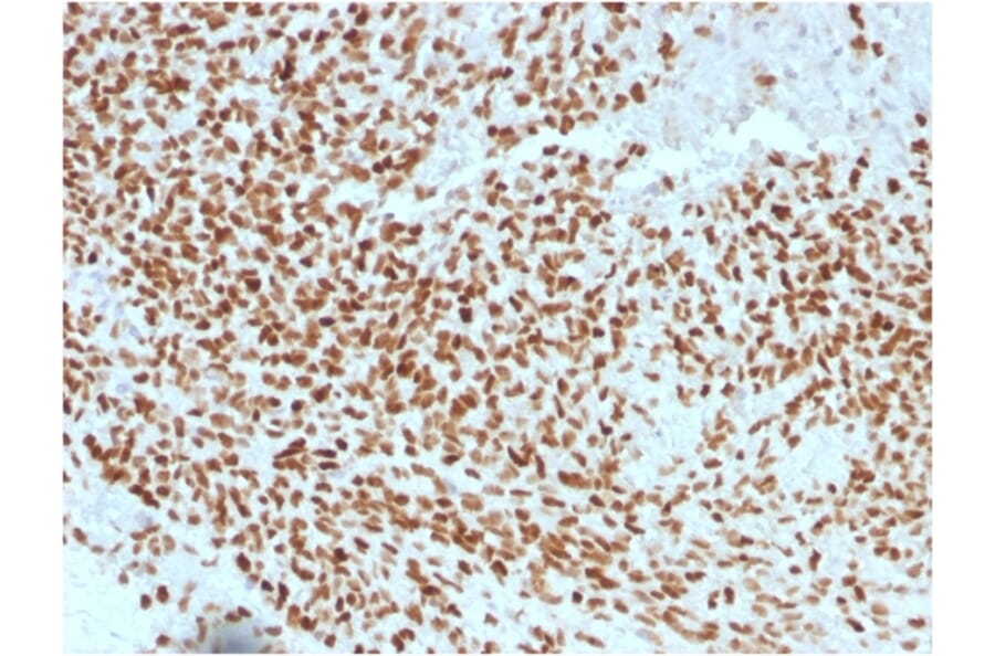 Immunohistochemistry - Anti-NKX2.2 Antibody [NX2/1523] (A249508) - Antibodies.com