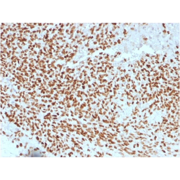 Immunohistochemistry - Anti-NKX2.2 Antibody [NX2/1523] (A249508) - Antibodies.com
