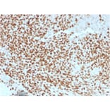 Immunohistochemistry - Anti-NKX2.2 Antibody [NX2/1523] (A249508) - Antibodies.com