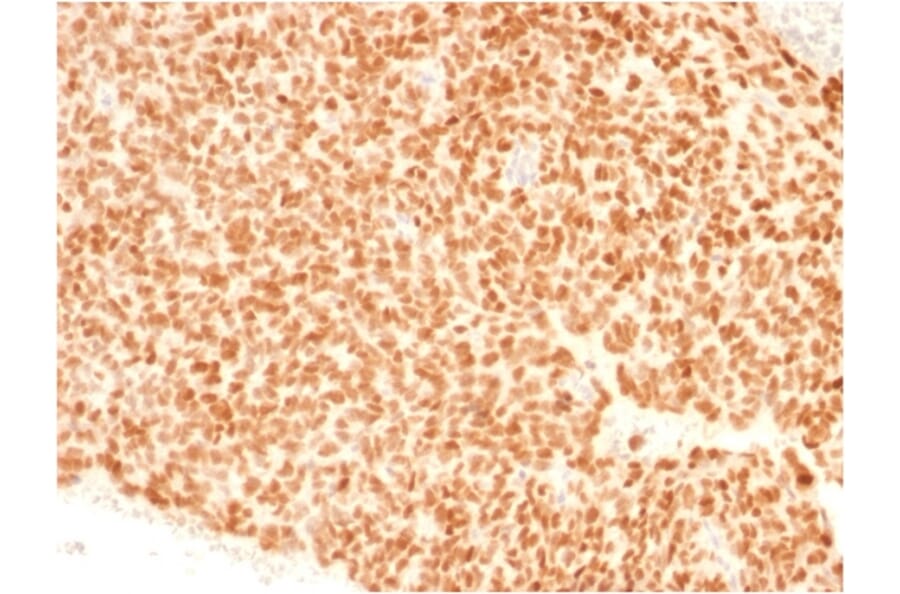 Immunohistochemistry - Anti-NKX2.2 Antibody [NX2/1523] (A249508) - Antibodies.com