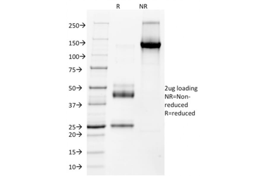 SDS-PAGE - Anti-NKX2.2 Antibody [NX2/1523] (A249508) - Antibodies.com