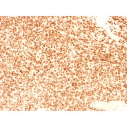 Immunohistochemistry - Anti-NKX2.2 Antibody [NX2/1524] (A249509) - Antibodies.com