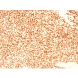 Immunohistochemistry - Anti-NKX2.2 Antibody [NX2/1524] (A249509) - Antibodies.com