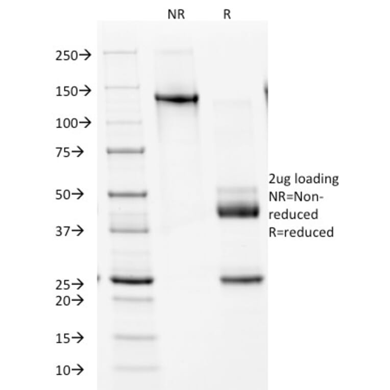 SDS-PAGE - Anti-NKX2.2 Antibody [NX2/1524] (A249509) - Antibodies.com