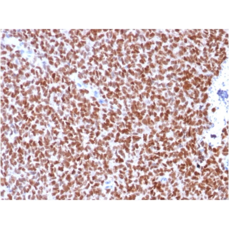 Immunohistochemistry - Anti-NKX2.2 Antibody [rNX2/294] (A249510) - Antibodies.com