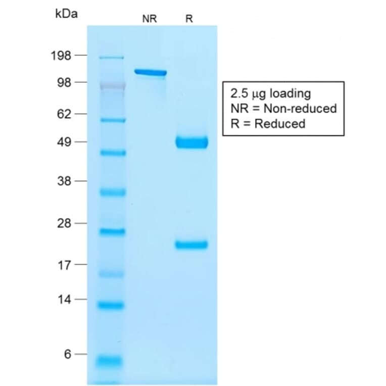 SDS-PAGE - Anti-NKX2.2 Antibody [rNX2/294] (A249510) - Antibodies.com