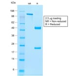 SDS-PAGE - Anti-NKX2.2 Antibody [rNX2/294] (A249510) - Antibodies.com