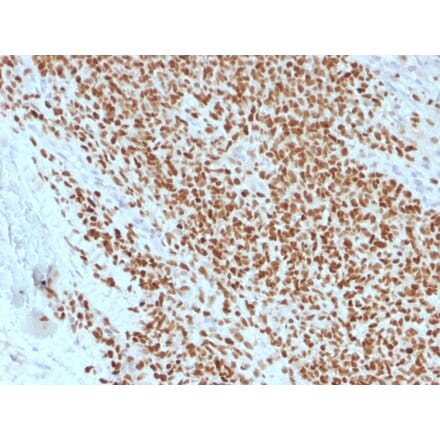 Immunohistochemistry - Anti-NKX2.2 Antibody [rNX2/1523] (A249510) - Antibodies.com