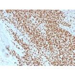 Immunohistochemistry - Anti-NKX2.2 Antibody [rNX2/1523] (A249510) - Antibodies.com