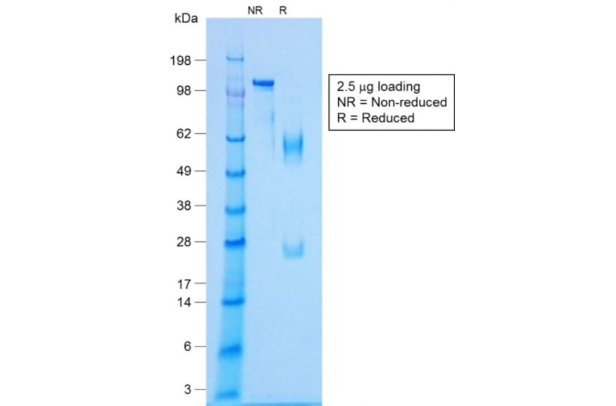 SDS-PAGE - Anti-NKX2.2 Antibody [NX2/1422R] (A249512) - Antibodies.com