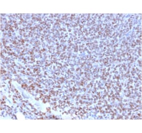 Immunohistochemistry - Anti-NKX2.2 Antibody [NX2/2198R] (A249512) - Antibodies.com