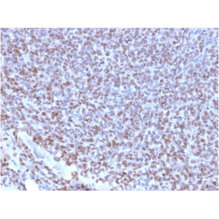 Immunohistochemistry - Anti-NKX2.2 Antibody [NX2/2198R] (A249512) - Antibodies.com