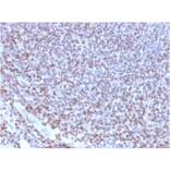 Immunohistochemistry - Anti-NKX2.2 Antibody [NX2/2198R] (A249512) - Antibodies.com
