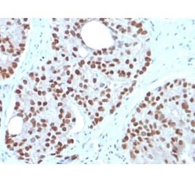 Immunohistochemistry - Anti-NKX3.1 Antibody [NKX3.1/3350] (A249515) - Antibodies.com