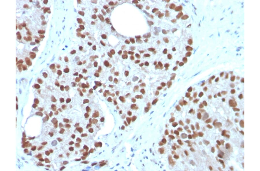 Immunohistochemistry - Anti-NKX3.1 Antibody [NKX3.1/3350] (A249515) - Antibodies.com