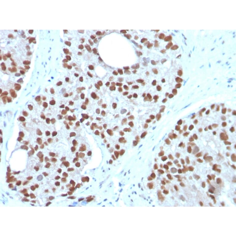 Immunohistochemistry - Anti-NKX3.1 Antibody [NKX3.1/3350] (A249515) - Antibodies.com