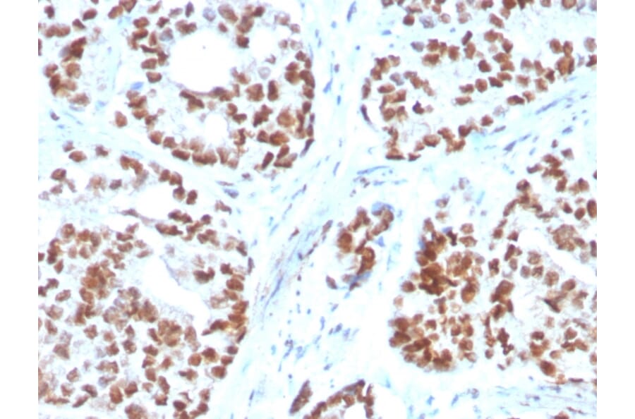 Immunohistochemistry - Anti-NKX3.1 Antibody [NKX3.1/3350] (A249515) - Antibodies.com