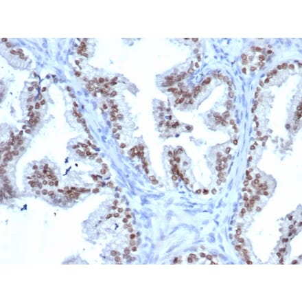 Immunohistochemistry - Anti-NKX3.1 Antibody [rNKX3.1/6620] (A249515) - Antibodies.com
