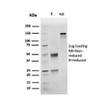 SDS-PAGE - Anti-NKX3.1 Antibody [rNKX3.1/6620] (A249516) - Antibodies.com
