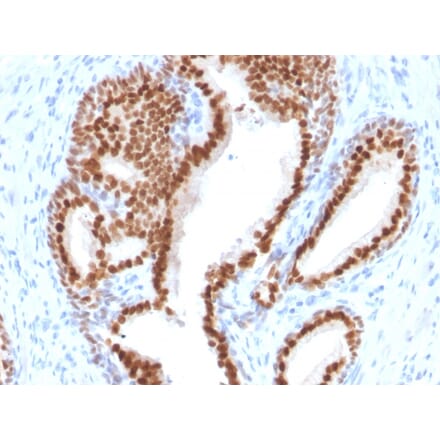 Immunohistochemistry - Anti-NKX3.1 Antibody [NKX3.1/2576] (A249517) - Antibodies.com