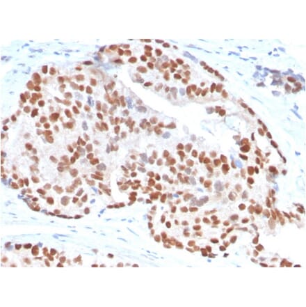 Immunohistochemistry - Anti-NKX3.1 Antibody [NKX3.1/3347] (A249519) - Antibodies.com