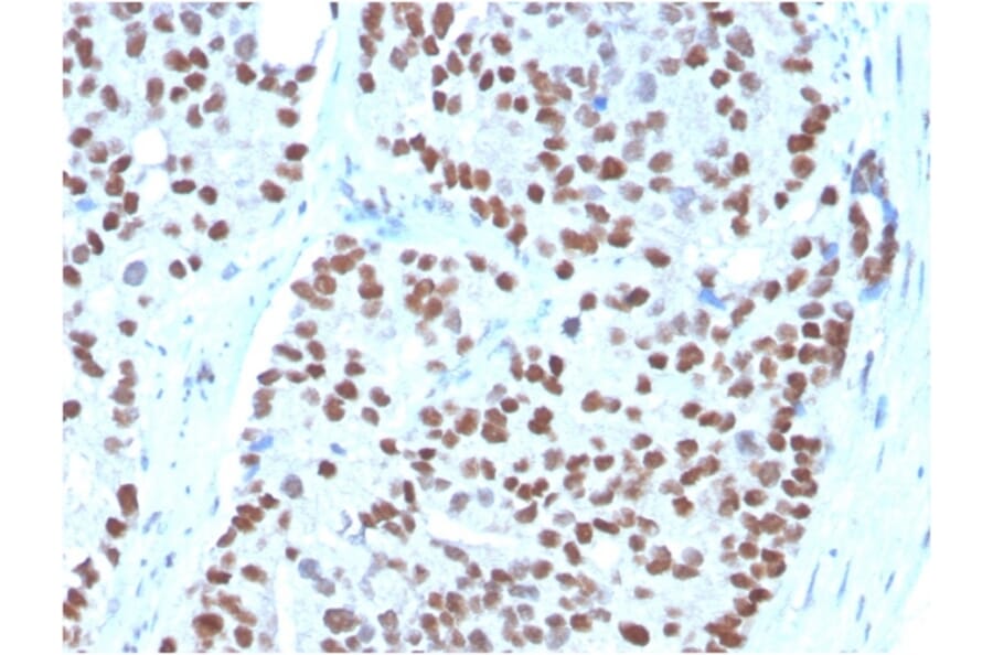 Immunohistochemistry - Anti-NKX3.1 Antibody [NKX3.1/3348] (A249520) - Antibodies.com