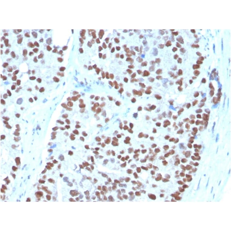 Immunohistochemistry - Anti-NKX3.1 Antibody [NKX3.1/3348] (A249520) - Antibodies.com