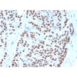 Immunohistochemistry - Anti-NKX3.1 Antibody [NKX3.1/3348] (A249520) - Antibodies.com