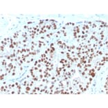 Immunohistochemistry - Anti-NKX3.1 Antibody [NKX3.1/3348] (A249520) - Antibodies.com