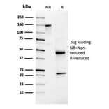 SDS-PAGE - Anti-NKX3.1 Antibody [NKX3.1/3348] (A249520) - Antibodies.com