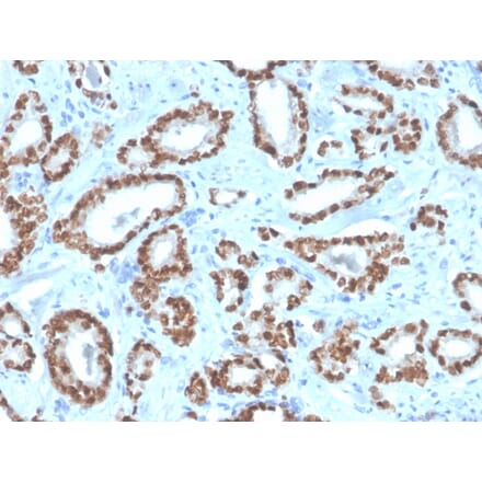 Immunohistochemistry - Anti-NKX3.1 Antibody [NKX3.1/4562R] (A249521) - Antibodies.com