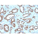 Immunohistochemistry - Anti-NKX3.1 Antibody [NKX3.1/4562R] (A249521) - Antibodies.com