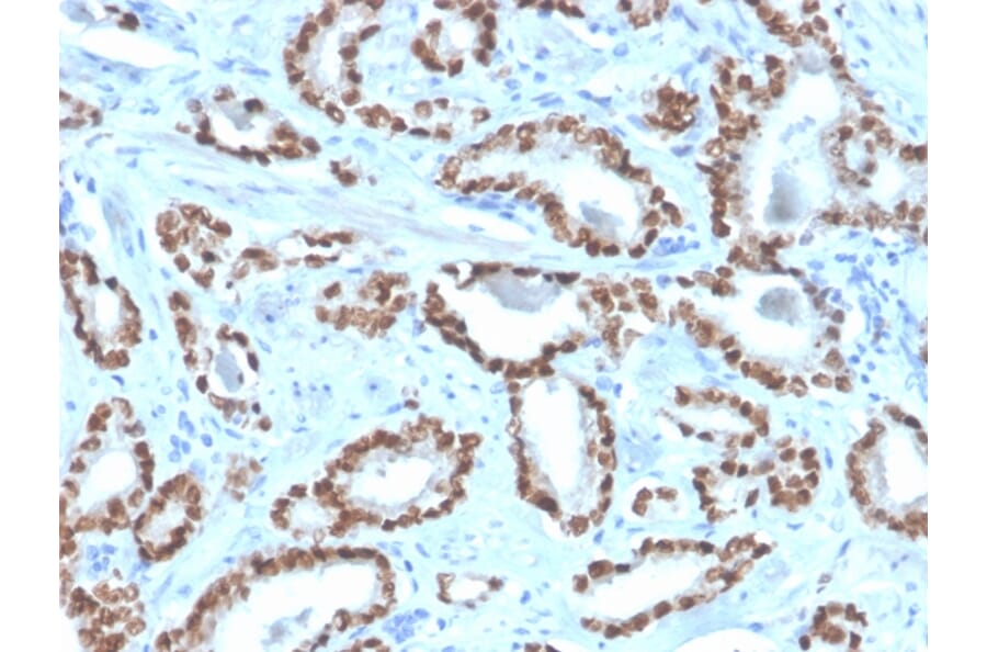 Immunohistochemistry - Anti-NKX3.1 Antibody [NKX3.1/4562R] (A249520) - Antibodies.com
