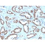 Immunohistochemistry - Anti-NKX3.1 Antibody [NKX3.1/4562R] (A249520) - Antibodies.com