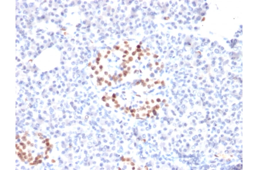 Immunohistochemistry - Anti-NKX6.1 Antibody [NKX61/2561] (A249522) - Antibodies.com