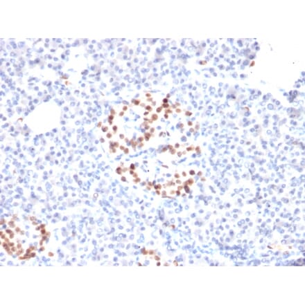 Immunohistochemistry - Anti-NKX6.1 Antibody [NKX61/2561] (A249522) - Antibodies.com