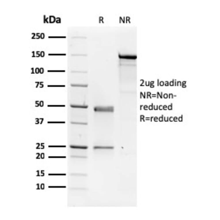 SDS-PAGE - Anti-NME1 Antibody [CPTC-NME1-2] (A249522) - Antibodies.com