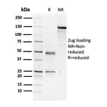 SDS-PAGE - Anti-NME1 Antibody [CPTC-NME1-2] (A249522) - Antibodies.com