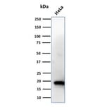 Western Blot - Anti-NME1 Antibody [CPTC-NME1-2] (A249523) - Antibodies.com