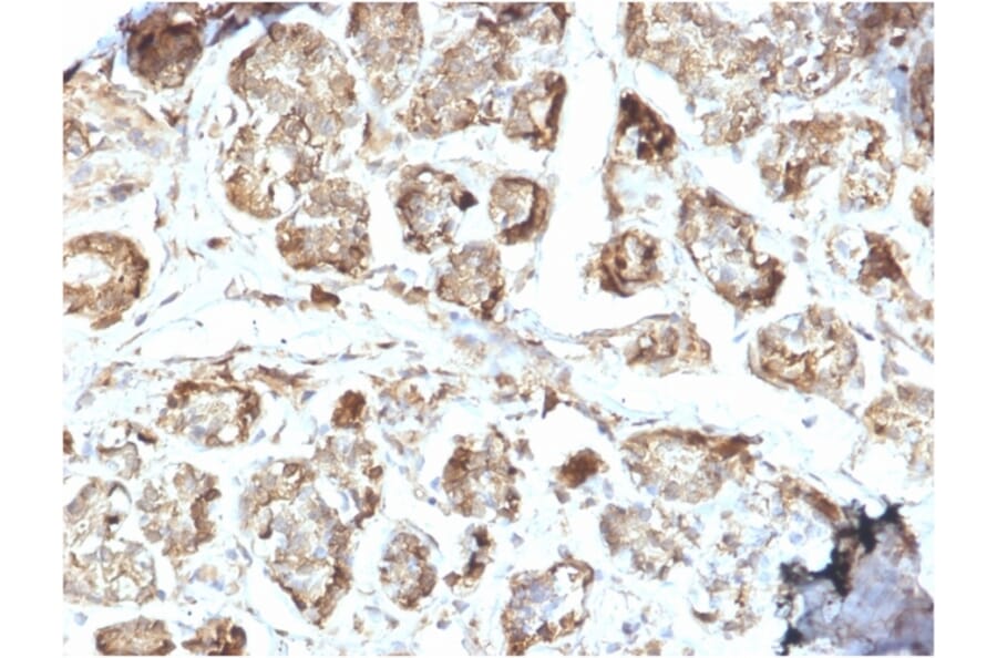 Immunohistochemistry - Anti-NME2 Antibody [CPTC-NME2-2] (A249524) - Antibodies.com