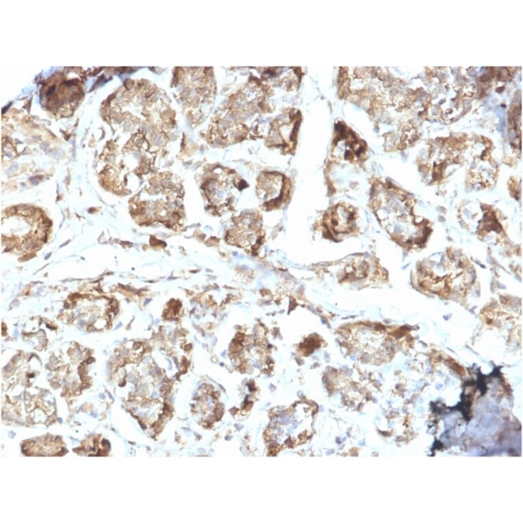Immunohistochemistry - Anti-NME2 Antibody [CPTC-NME2-2] (A249524) - Antibodies.com