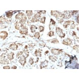 Immunohistochemistry - Anti-NME2 Antibody [CPTC-NME2-2] (A249524) - Antibodies.com