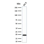 Western Blot - Anti-NME2 Antibody [CPTC-NME2-2] (A249524) - Antibodies.com