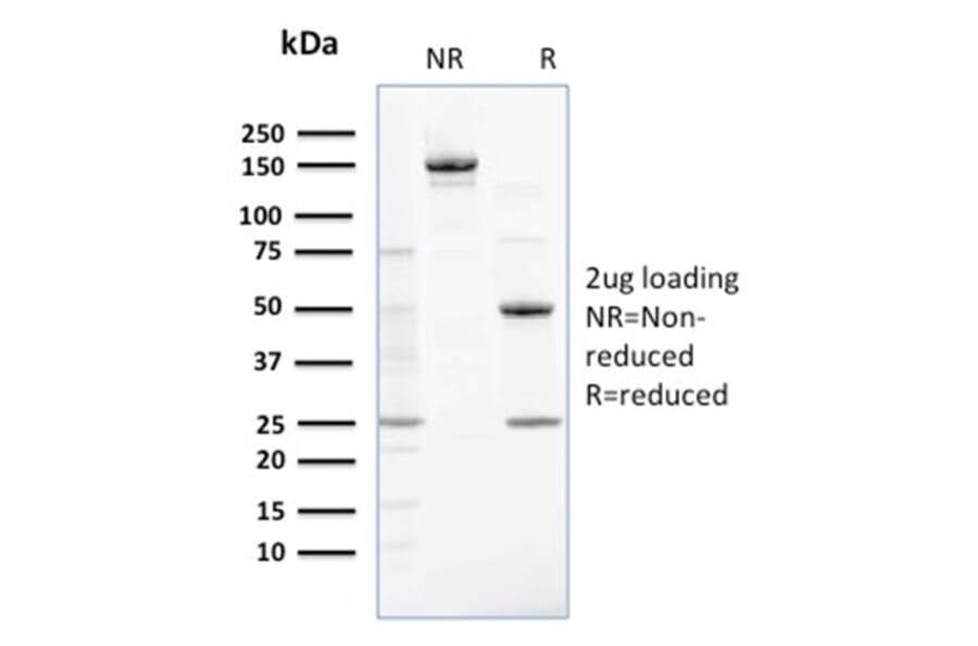 SDS-PAGE - Anti-NME2 Antibody [CPTC-NME2-2] (A249524) - Antibodies.com
