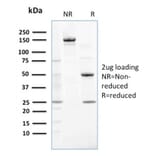 SDS-PAGE - Anti-NME2 Antibody [CPTC-NME2-2] (A249524) - Antibodies.com