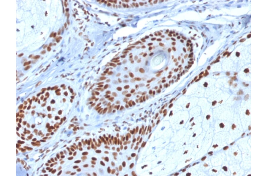 Immunohistochemistry - Anti-Nucleophosmin Antibody [NPM1/1902] (A249525) - Antibodies.com