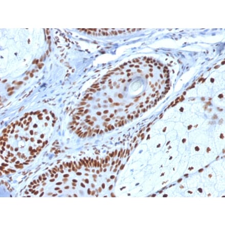Immunohistochemistry - Anti-Nucleophosmin Antibody [NPM1/1902] (A249525) - Antibodies.com